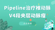 Pipeline治疗椎动脉V4段夹层动脉瘤