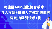功能区AVM出血复合手术：介入栓塞+机器人导航定位血肿穿刺抽吸引流术1例