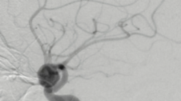 brainmed
