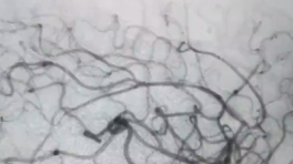 brainmed