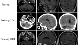 brainmed