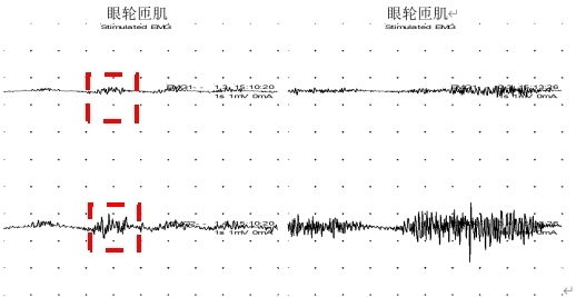 已修改.png