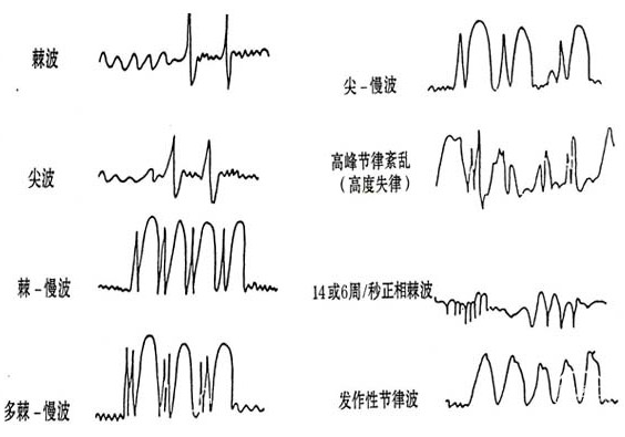 脑电波-2.png
