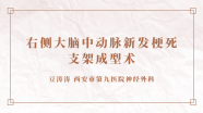 豆涛涛教授：右侧大脑中动脉新发梗死支架成型术