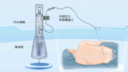 腰椎穿刺脑脊液引流装置