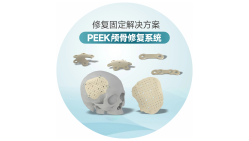 PEEK颅骨修复系统