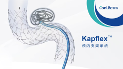 Kapflex™颅内支架系统