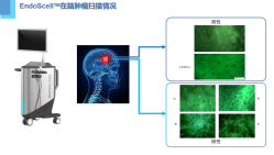 EndoSCell™（安刀)