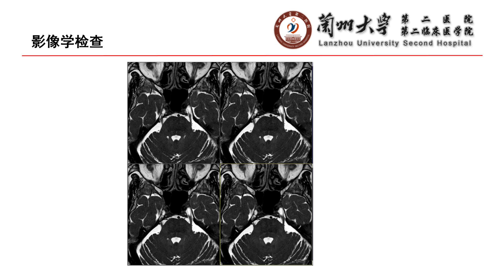 幻灯片4.png