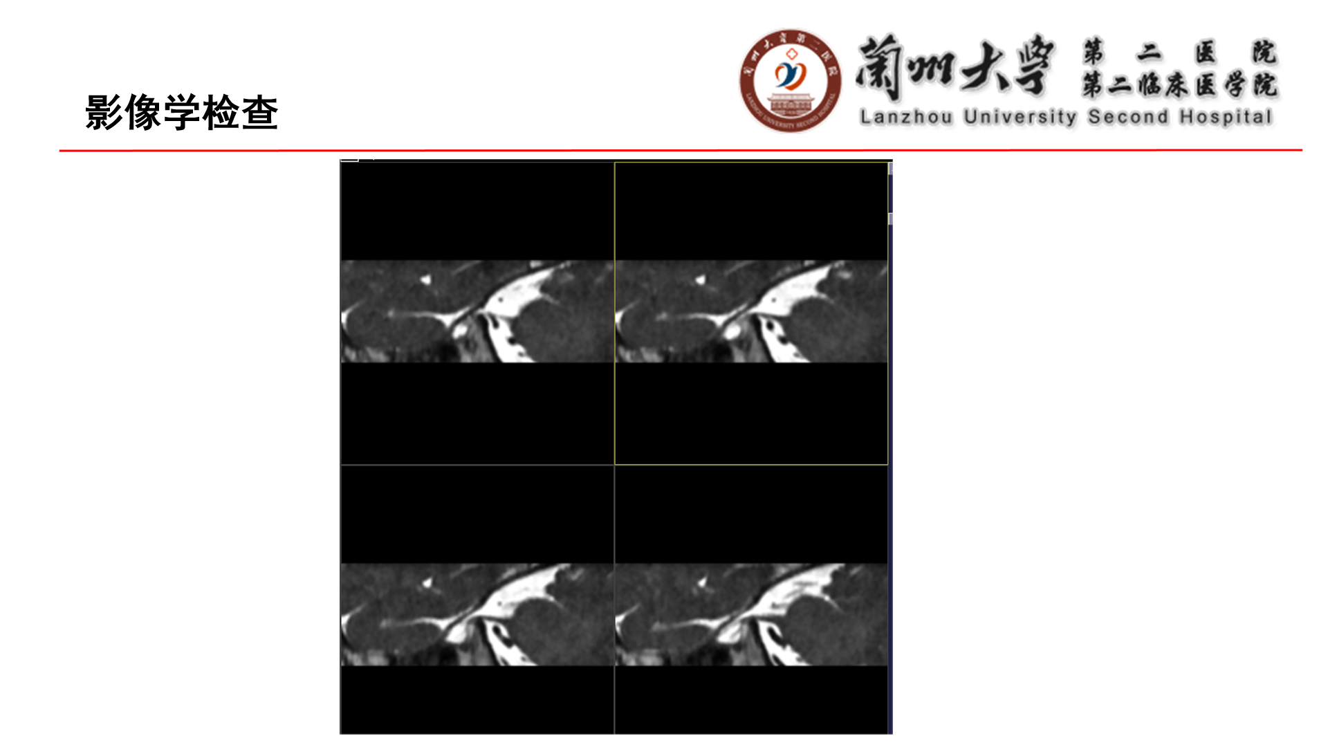 幻灯片5.png