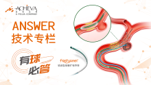 有"球"必"答"，锦囊妙技丨河南理工大学第一附属医院：ANSWER技术结合血流导向装置治疗狭窄合并动脉瘤一例