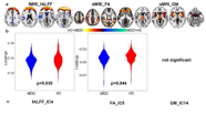 Brain: 未用药重度抑郁症中 MicroRNA132 与多模态神经影像学模式相关