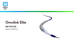 Omnilink Elite 锁骨下球扩支架