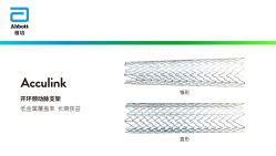Acculink 开环颈动脉支架