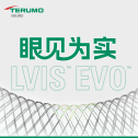 眼见为实｜LVIS™ EVO™支架全国首批植入：右侧大脑后动脉P1段动脉瘤治疗一例
