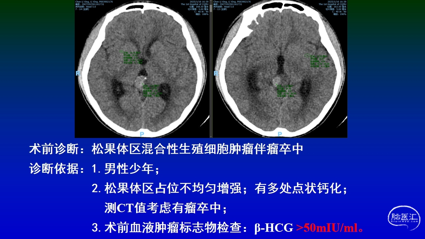 null 微信截图_20250526160126.png