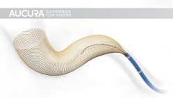 AUCURA™️血流导向密网支架