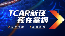 TCAR新径 颈在掌握