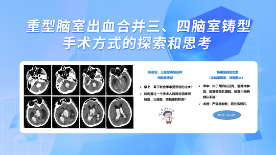 重型脑室出血合并三、四脑室铸型手术方式的探索和思考
