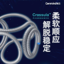 【聚汇医声】Crassula™弹簧圈治疗左侧大脑前交通动脉瘤一例