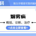 【脑医专家团】对抗烟雾病不再迷茫！权威专家团队为您导航