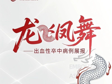 【通桥•龙飞凤舞】飞龙™辅助支架治疗中动脉分叉部动脉瘤一例