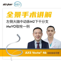 【全景手术讲解】AXS Vecta 46抽吸导管用于左侧大脑中动脉M2下干分支MeVO取栓治疗