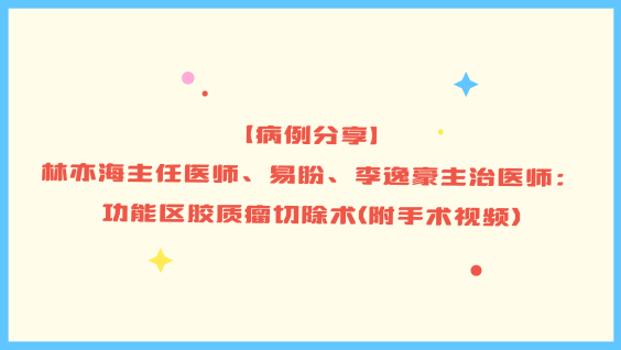 【病例分享】林亦海主任医师、易盼、李逸豪主治医师：功能区胶质瘤切除术（附手术视频）